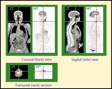 PET diagnostics: positron emission tomography